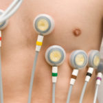 The Benefits Of Patient Monitoring Devices