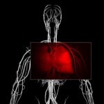 An upper body x-ray with the lungs highlighted in red.